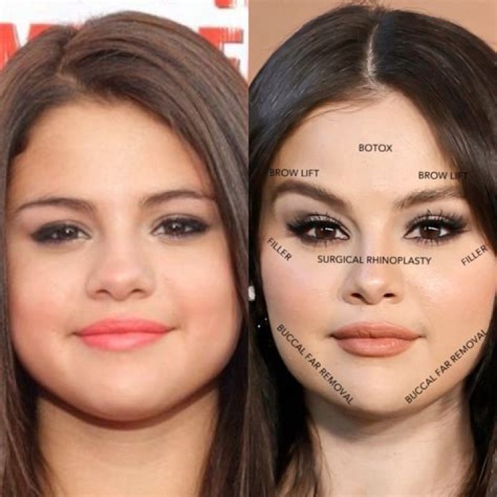 Lexi Martone Plastic Surgery comparison